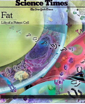 Fat cells for an feature article in The New York Times on the potent metabolic, hormonal and chemical effects on the body. Linda Nye 